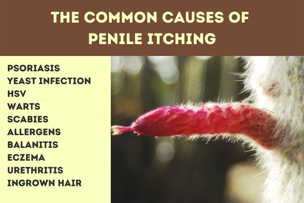 The Common Causes of Penile Itching
