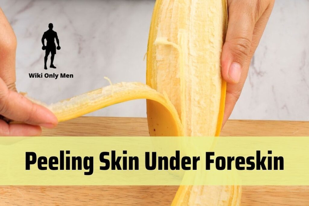 Peeling Skin Under Foreskin