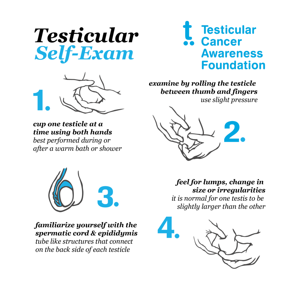 TSE-Testicular Self Exam