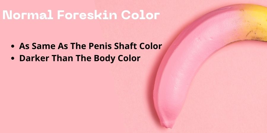 Normal Foreskin Color